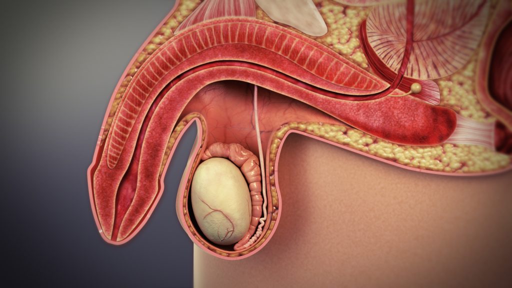 infertilidade